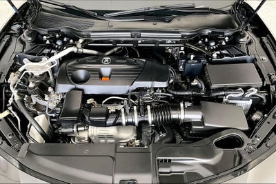2025 Acura TLX Technology Package