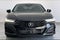 2025 Acura TLX Technology Package