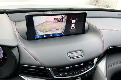 2025 Acura TLX A-Spec Package SH-AWD