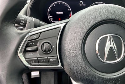 2025 Acura TLX Technology Package